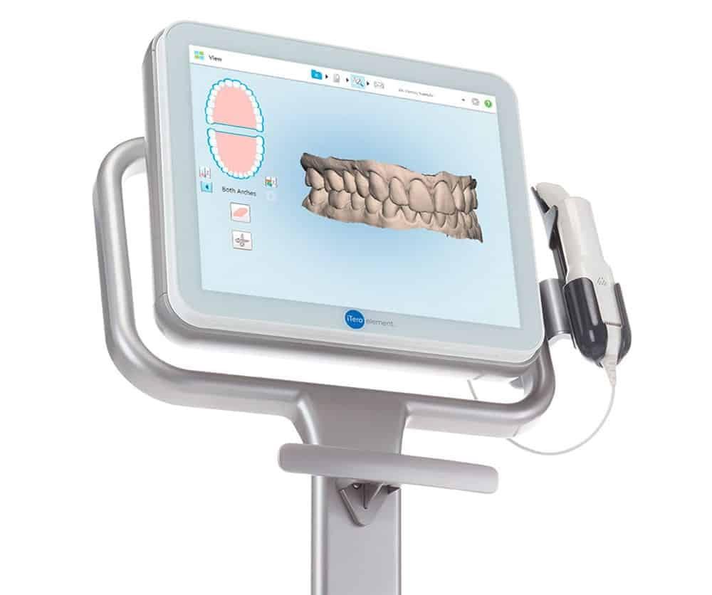 SCANER INTRAORAL ITERO + DIAGNÓSTICO DE CARIES ITERO NIRI